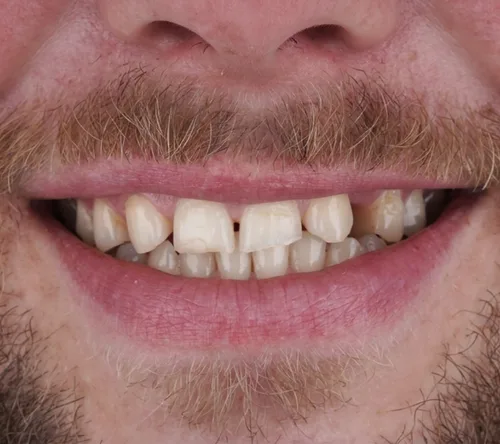 Pred ošetrením